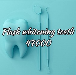 Flash Лазерное отбеливание зубов